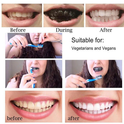 100% Natural Teeth Whitening - 30g