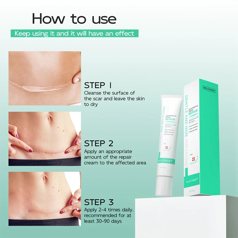 Maycheer Gentle and Non-Irritating Scar Removal Cream Repair 15g