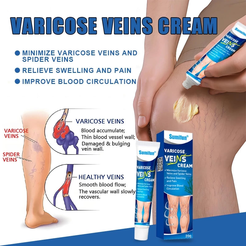 Sumifun Varicose Veins Cream Varicose Veins Remover 20g