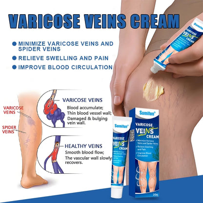Sumifun Varicose Veins Cream Varicose Veins Remover 20g