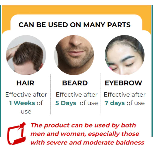 Minoxidil Strands Hair Regrowth Treatment