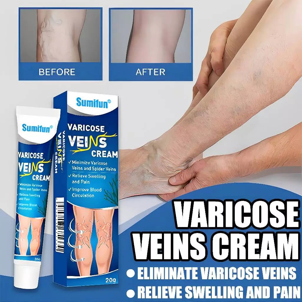 Sumifun Varicose Veins Cream Varicose Veins Remover 20g