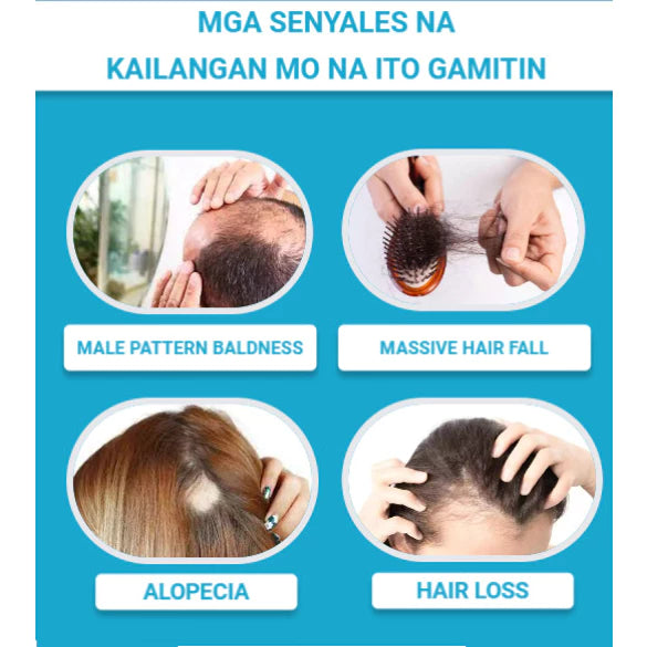 Minoxidil Strands Hair Regrowth Treatment
