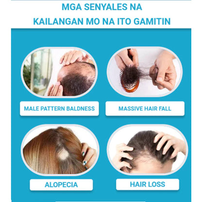 Minoxidil Strands Hair Regrowth Treatment