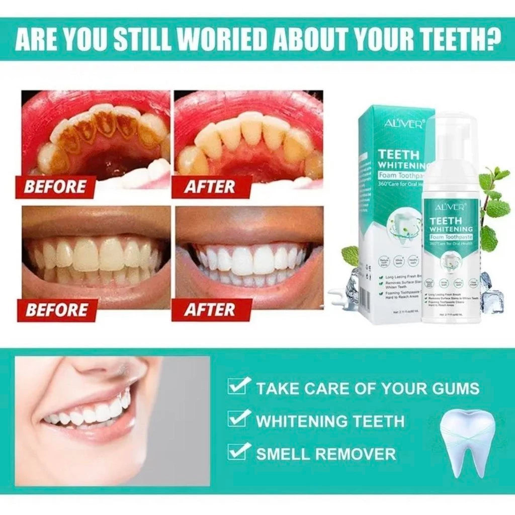 Teeth Whitening Foam Toothpaste Prevents Yellowing of Teeth