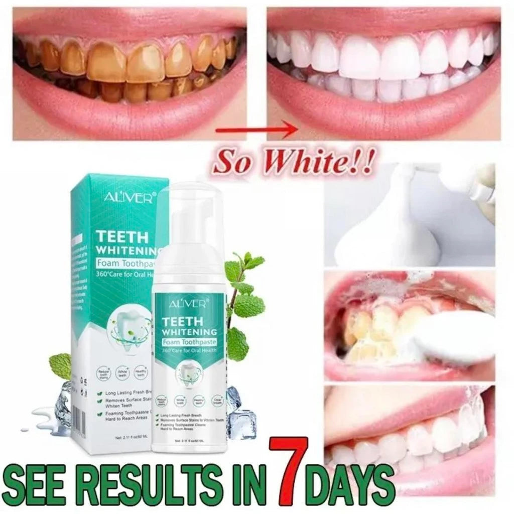 Teeth Whitening Foam Toothpaste Prevents Yellowing of Teeth