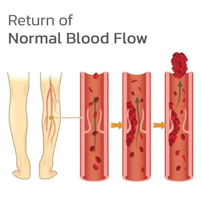 Varicose Veins Remover Patch Smoothes the Bulge of Blood Vessels (12pcs)