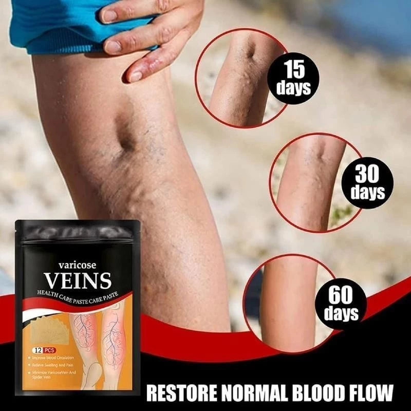 Varicose Veins Remover Patch Smoothes the Bulge of Blood Vessels (12pcs)