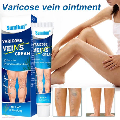 Sumifun Varicose Veins Cream Varicose Veins Remover 20g